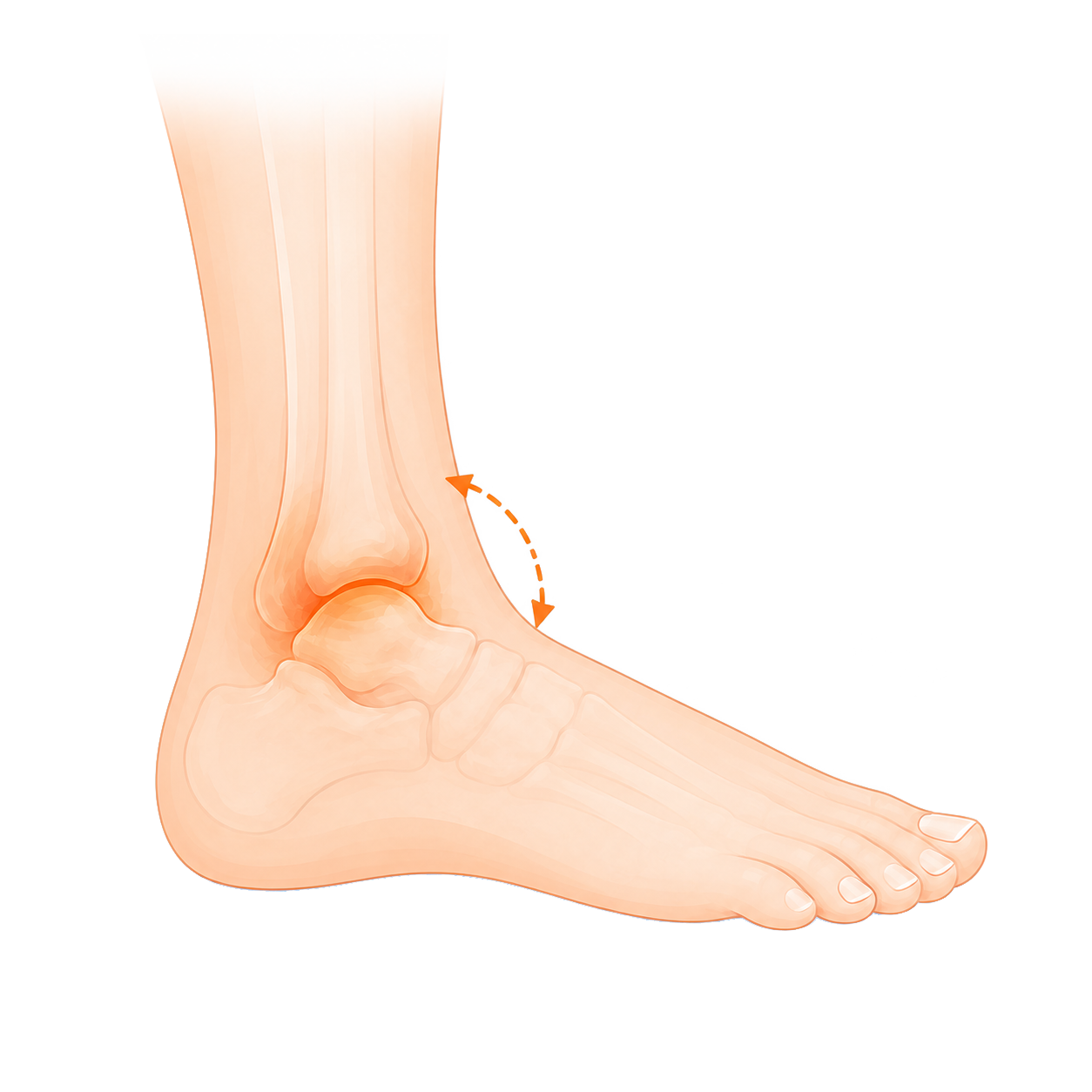 Reduced movement of the upper ankle joint Rondom